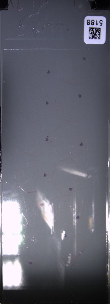 Media type: image; Special Collections 4011   shows specimen_part histological serial section;